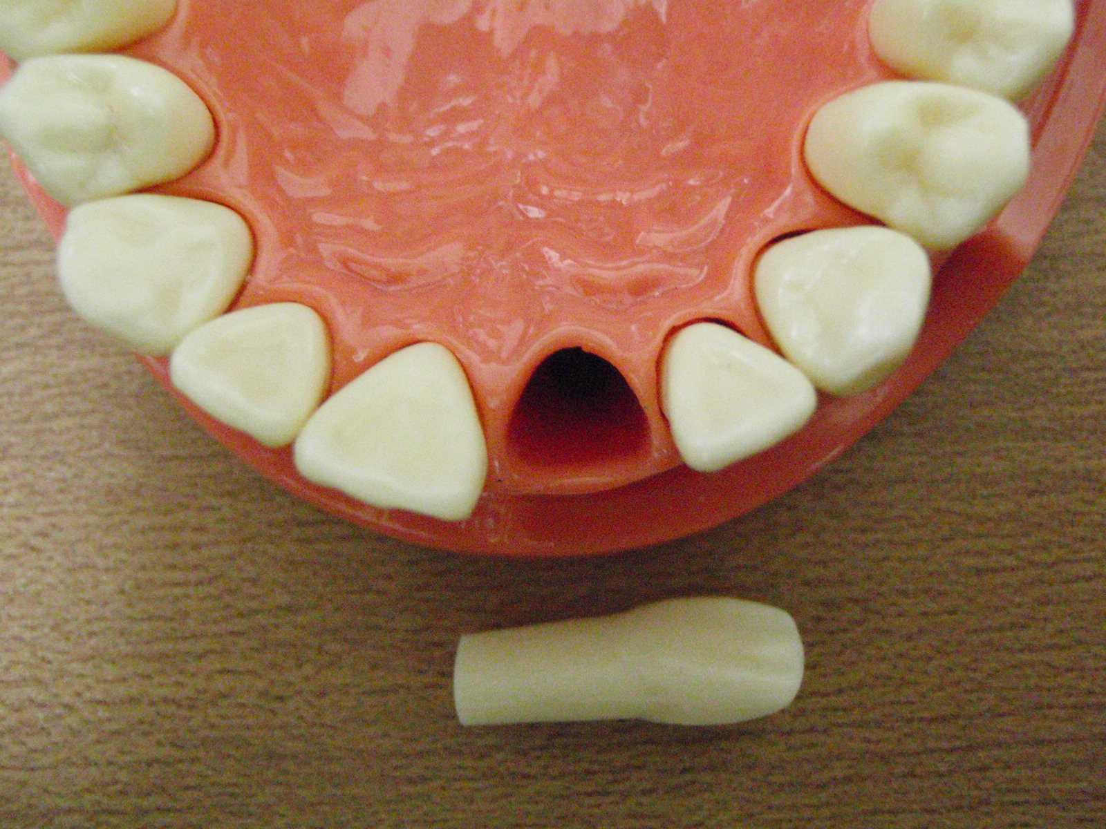 前歯の抜歯値段